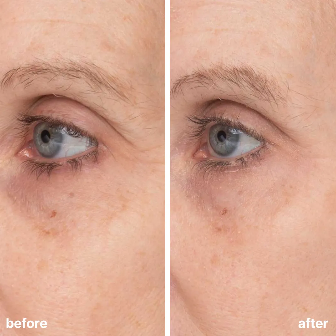Bakuchiol Eye Repair Cream (CC)