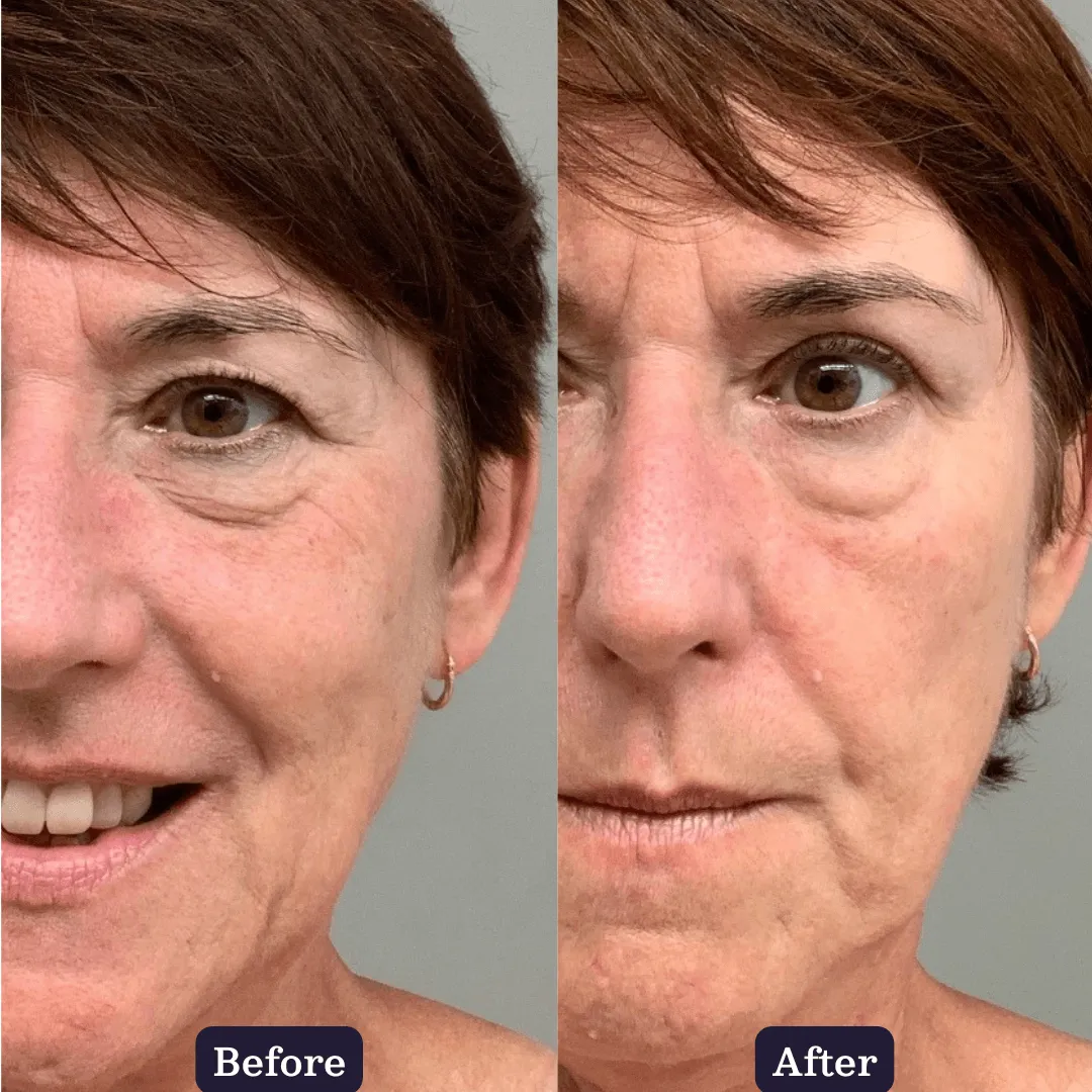Plant Collagen Plumping Booster Serum