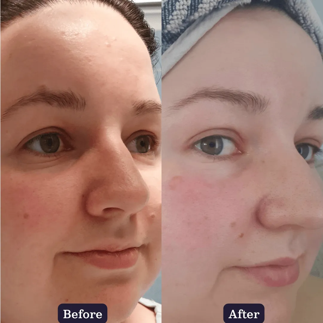 Plant Collagen Plumping Booster Serum