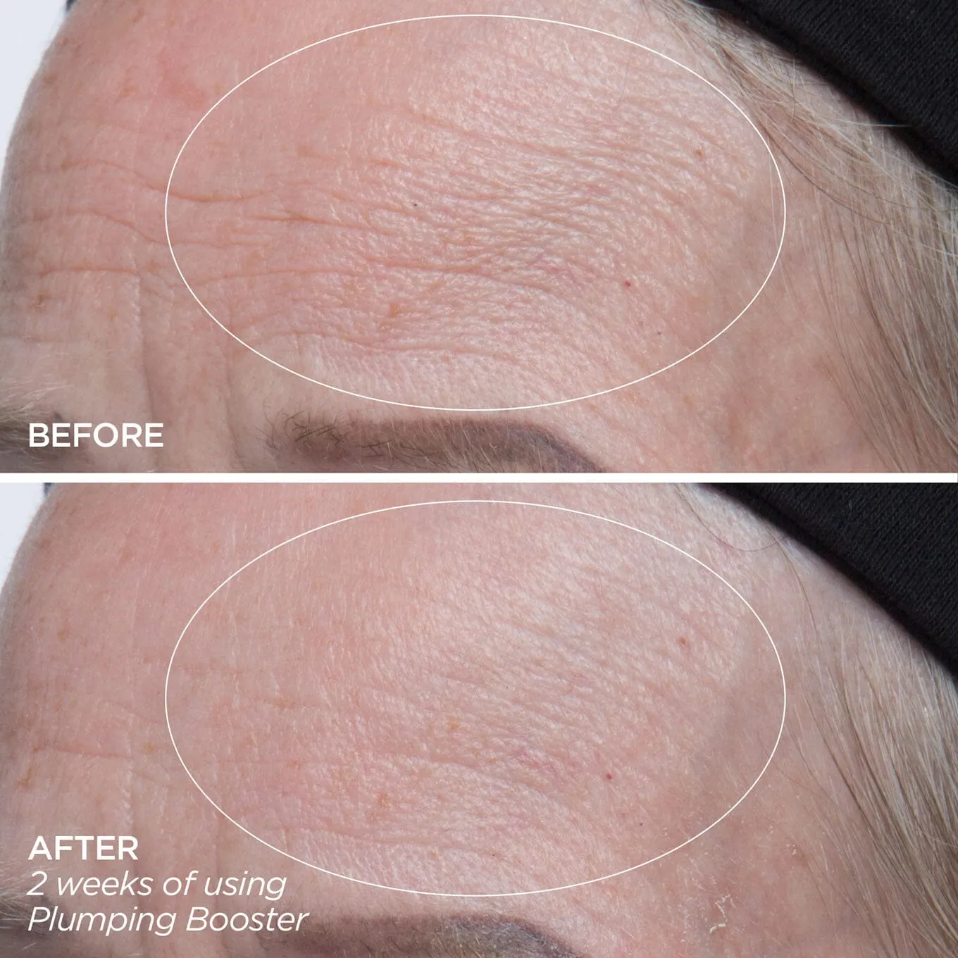 Plumping Booster