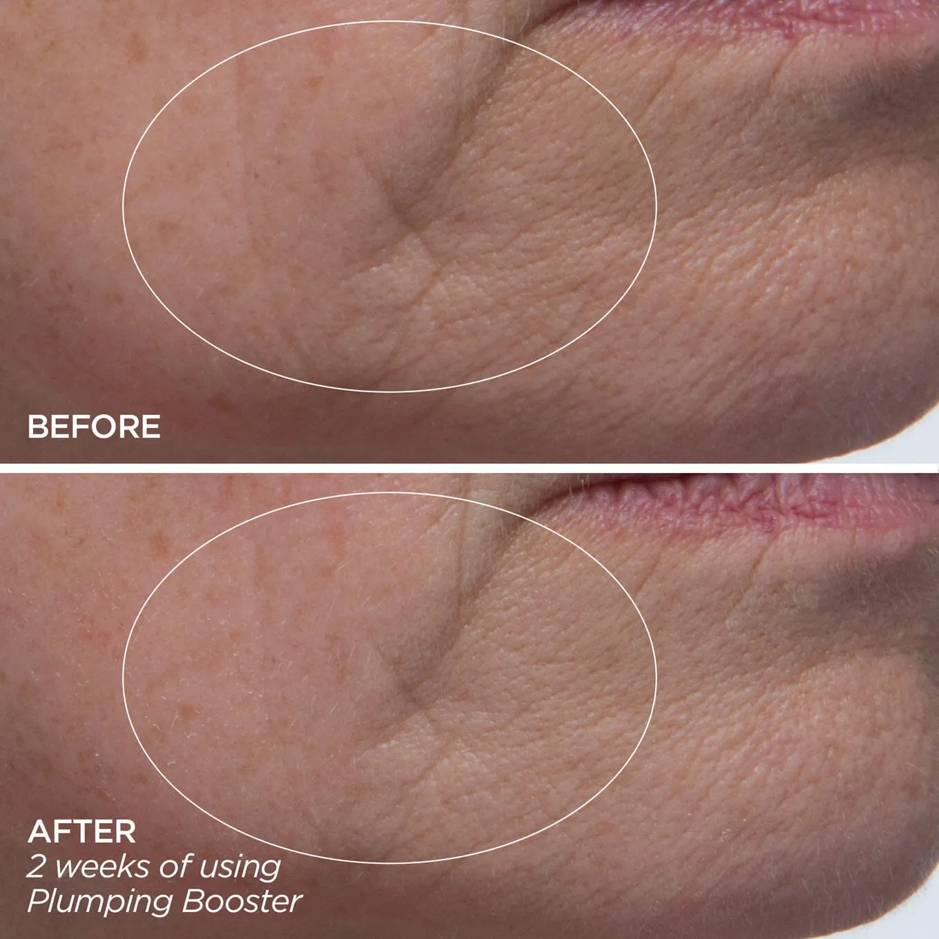 Plumping Booster