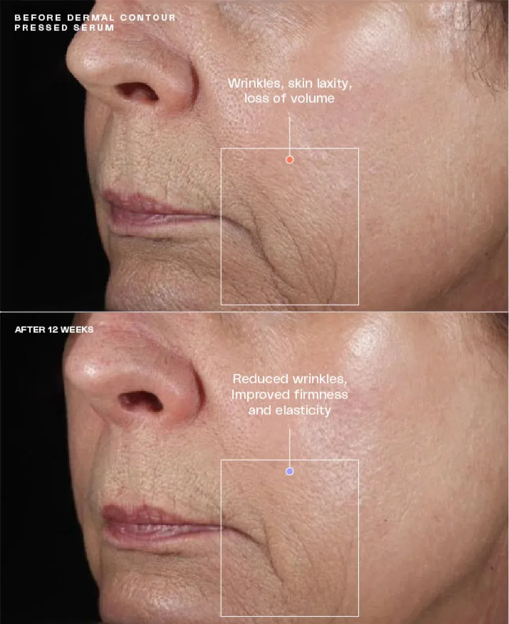 SENTE HydraFirm (Dermal Contour Pressed Serum)